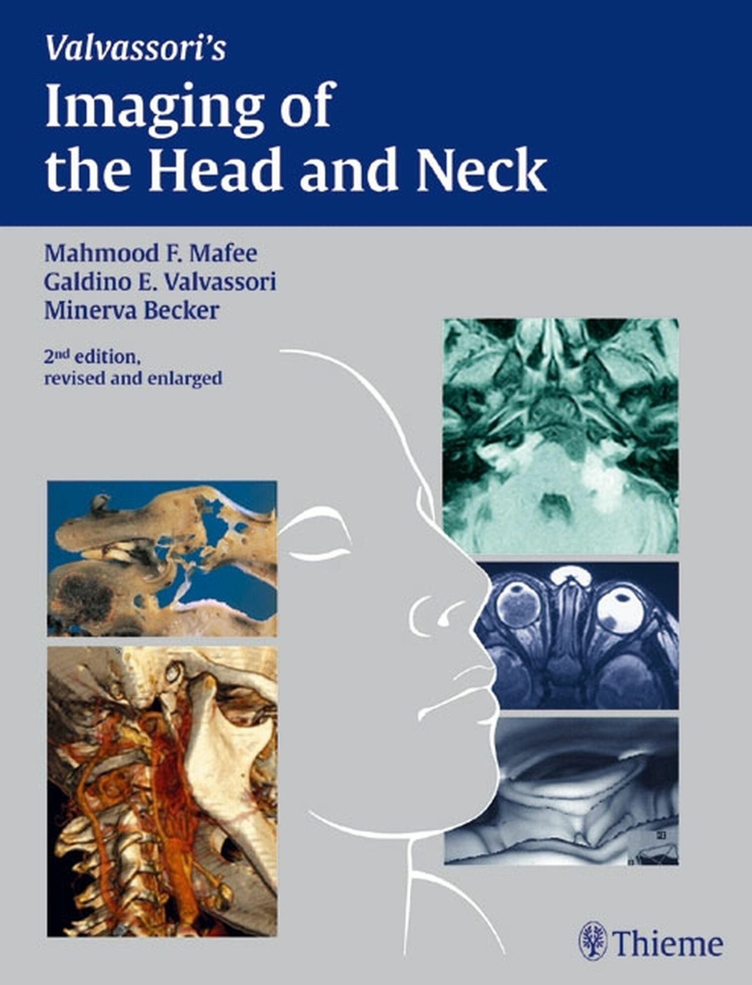 Cover Imaging of the Head and Neck