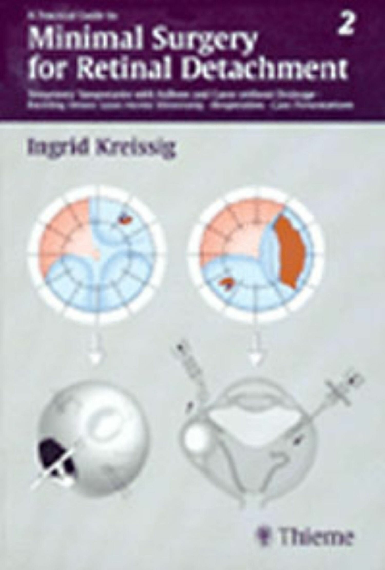 Cover A Practical Guide to Minimal Surgery for Retinal Detachment, Vol. 2