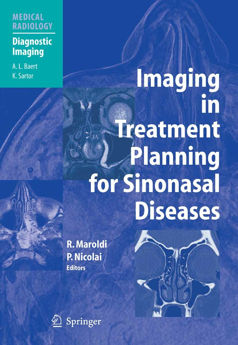 Imaging in Treatment Planning for Sinonasal Diseases