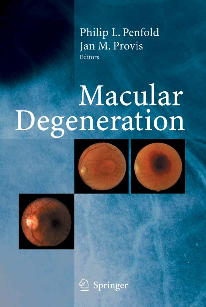 Macular Degeneration