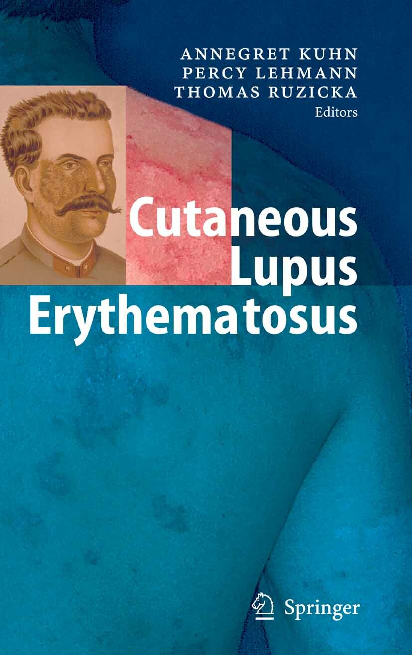 Cover Cutaneous Lupus Erythematosus