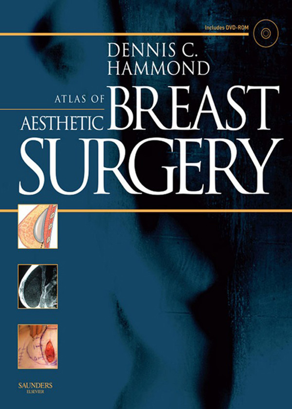 Atlas of Aesthetic Breast Surgery