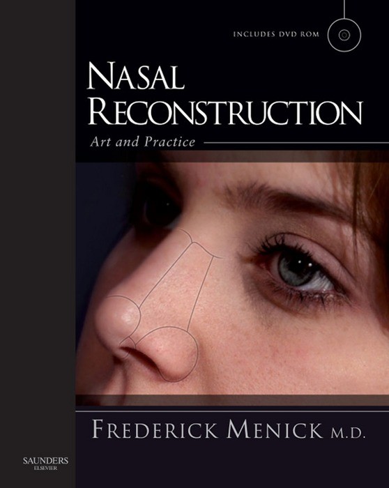 Cover Nasal Reconstruction: Art and Practice