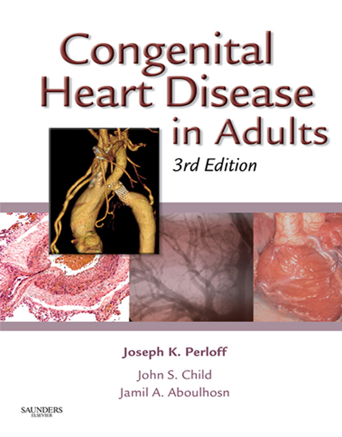 Cover Congenital Heart Disease in Adults