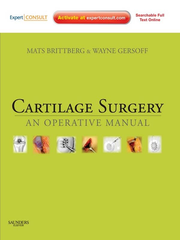Cover Cartilage Surgery E-Book