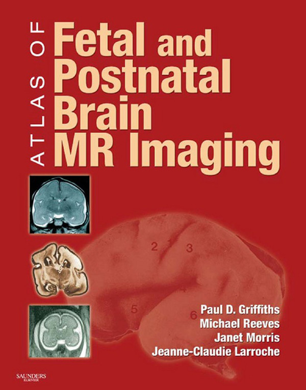 Atlas of Fetal and Infant Brain MR