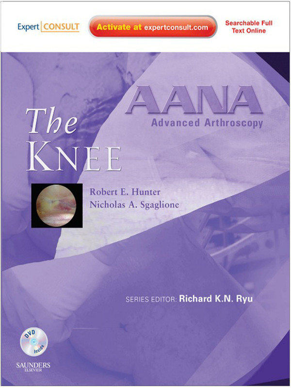 AANA Advanced Arthroscopy: The Knee