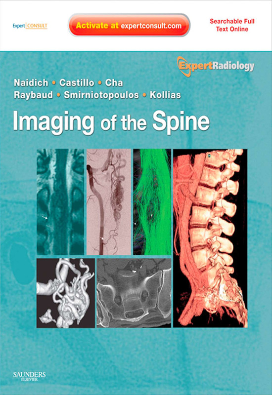 Cover Imaging of the Spine E-Book
