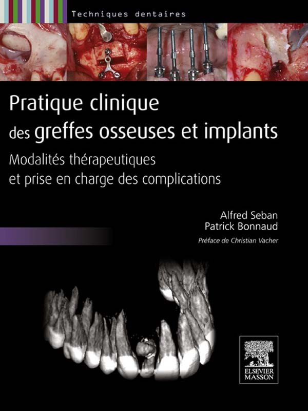 Cover Pratique clinique des greffes osseuses et implants