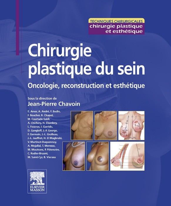 Cover Chirurgie plastique du sein