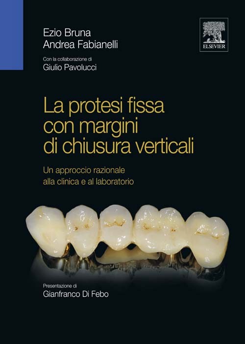 Cover La protesi fissa con margini di chiusura verticali