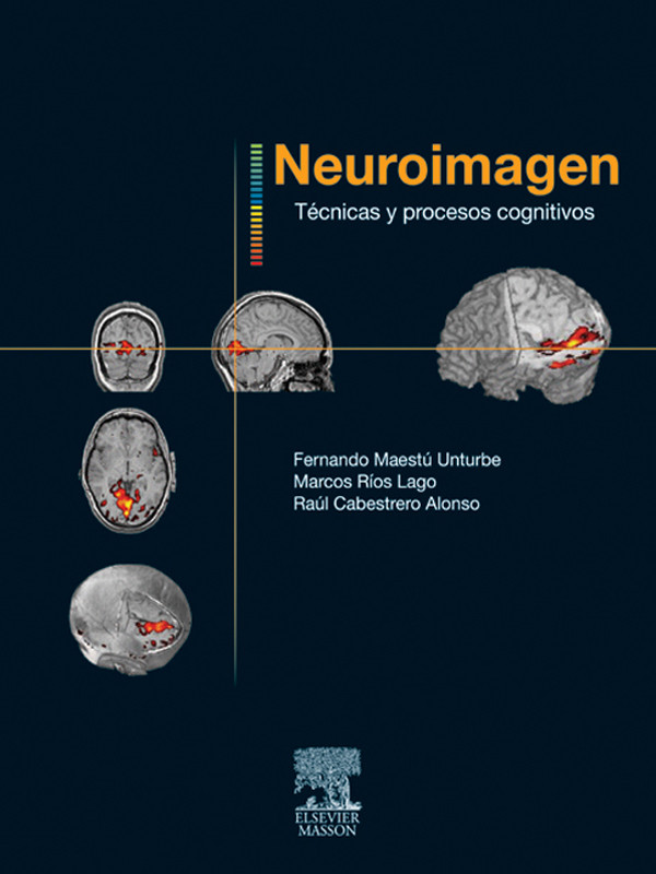 Neuroimagen. Técnicas y procesos cognitivos