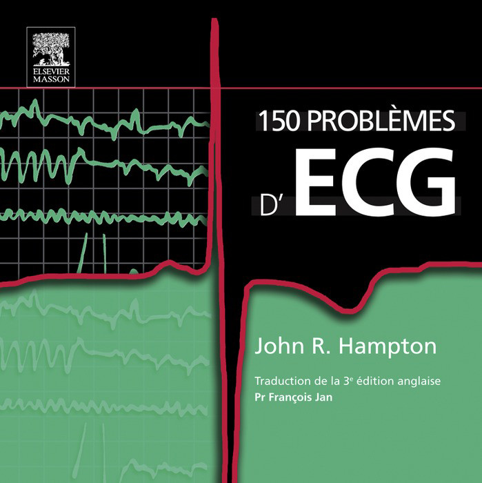 Cover 150 problèmes d'ECG