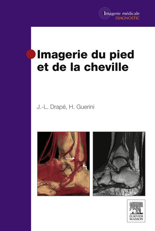 Cover Imagerie du pied et de la cheville