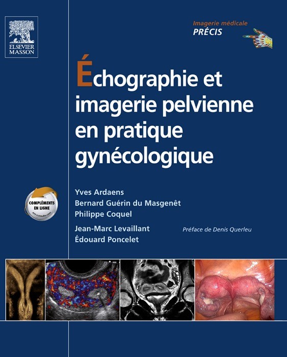 Échographie et imagerie pelvienne en pratique gynécologique