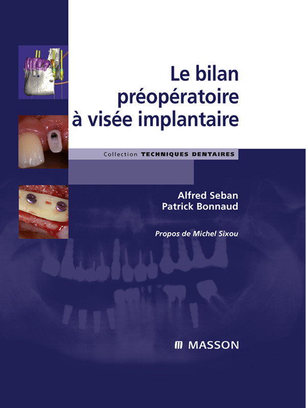 Cover Le bilan préopératoire à visée implantaire