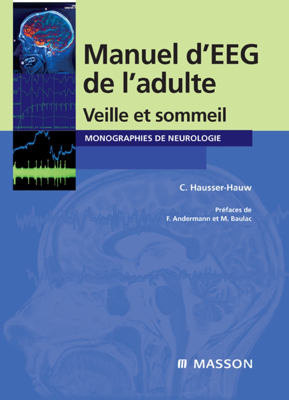 Cover Manuel d'EEG de l'adulte