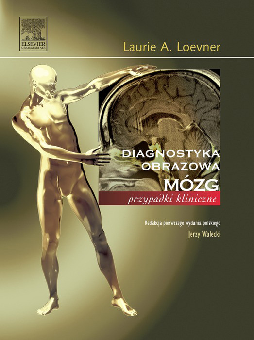 Cover Mózg. Seria Diagnostyka Obrazowa Przypadki kliniczne