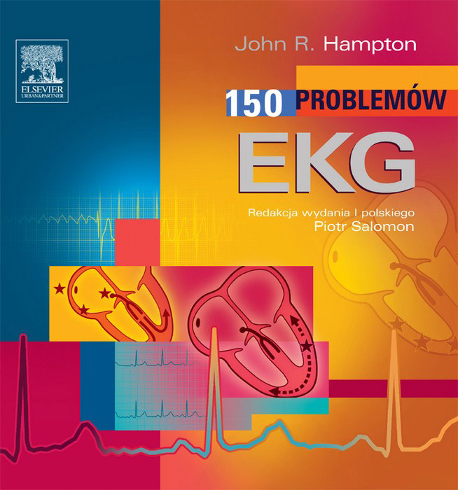 150 Problemów EKG