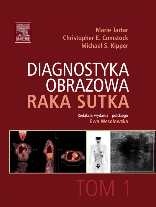 Diagnostyka obrazowa raka sutka. Tom 1