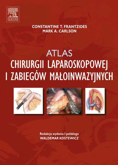 Atlas chirurgii laparoskopowej i zabiegów maloinwazyjnych