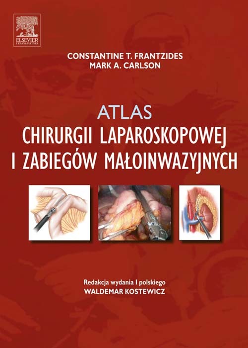 Cover Atlas chirurgii laparoskopowej i zabiegów maloinwazyjnych