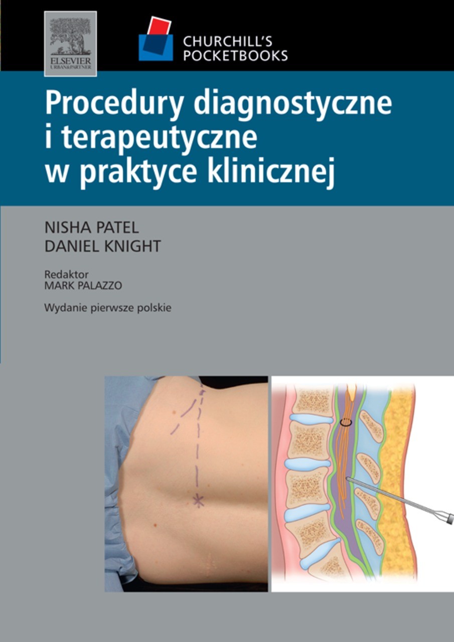 Procedury diagnostyczne i terapeutyczne w praktyce klinicznej. Seria Churchill's Pocketbooks