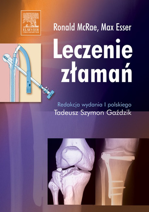 Cover Leczenie zlaman