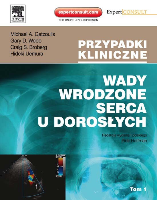 Cover Wady wrodzone serca u doroslych. Seria Przypadki Kliniczne. Tom 1