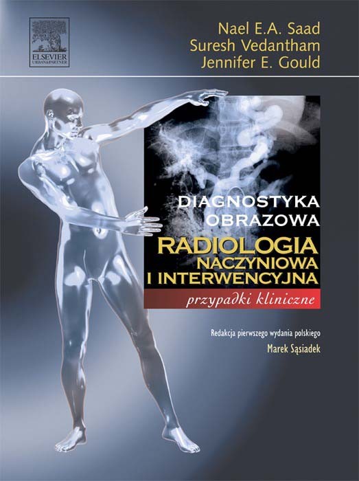 Cover Radiologia naczyniowa i interwencyjna. Seria Diagnostyka Obrazowa Przypadki Kliniczne