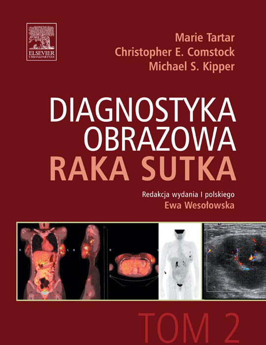 Diagnostyka obrazowa raka sutka. Tom 2