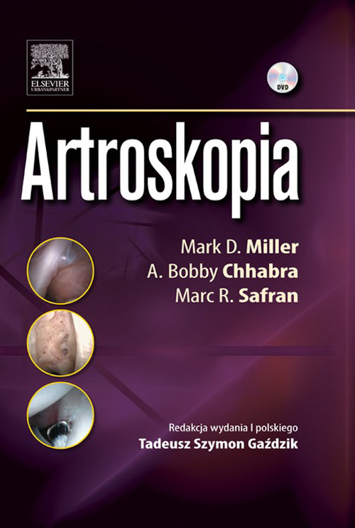 Artroskopia