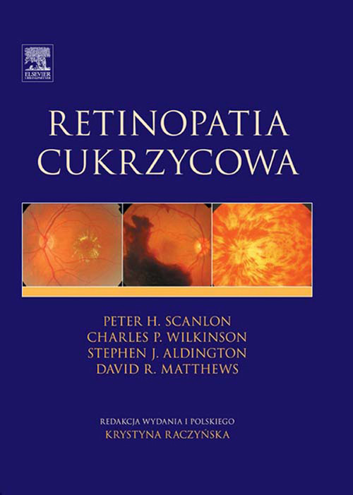 Cover Retinopatia cukrzycowa