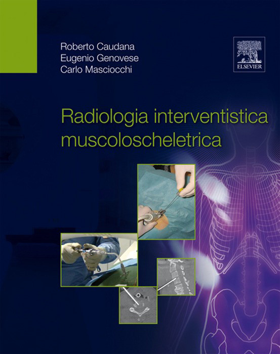 Cover Radiologia interventistica muscoloscheletrica