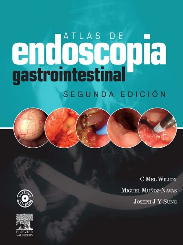 Cover Atlas de Endoscopia Gastrointestinal Clinica