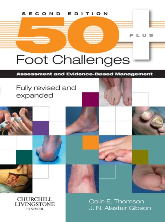 Cover 50+ Foot Challenges E-Book