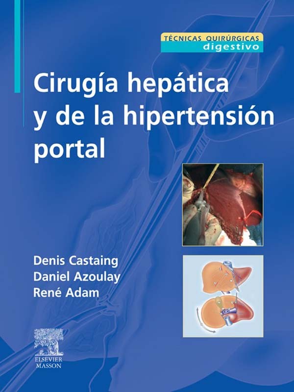 Cover Cirugía hepática y de la hipertensión portal