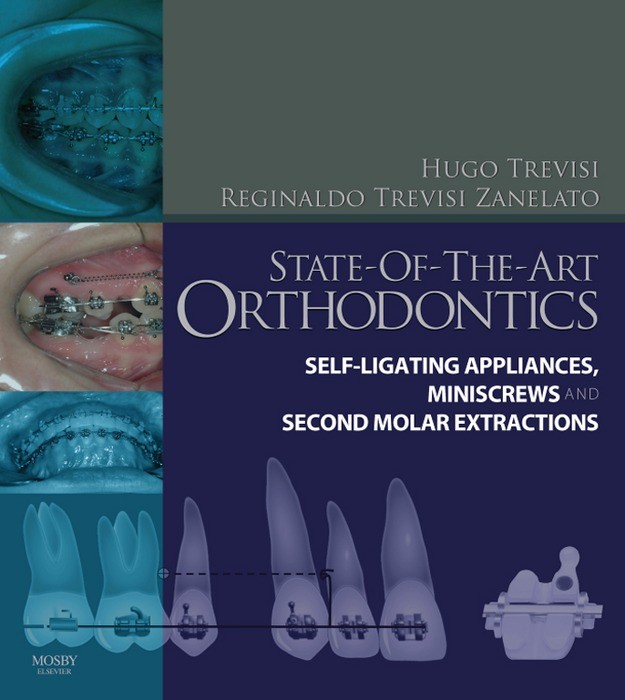 Cover State-of-the-Art Orthodontics E-Book