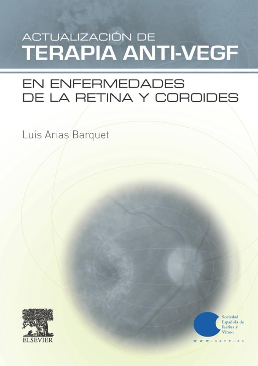 Cover Actualización de Terapia Anti-VEGF en enfermedades de la retina y coroides