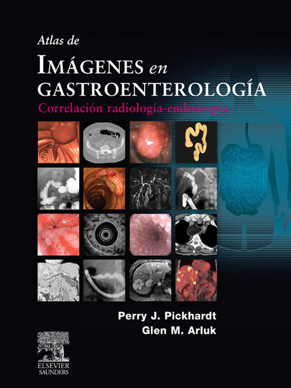 Cover Atlas de imágenes en gastroenterología