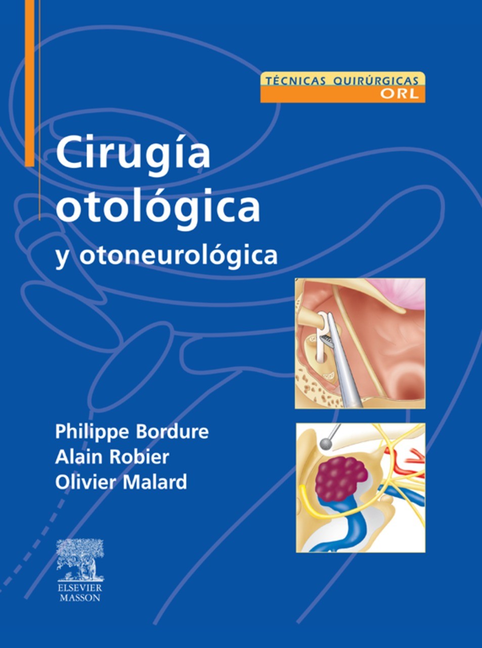 Cirugía otológica y otoneurológica