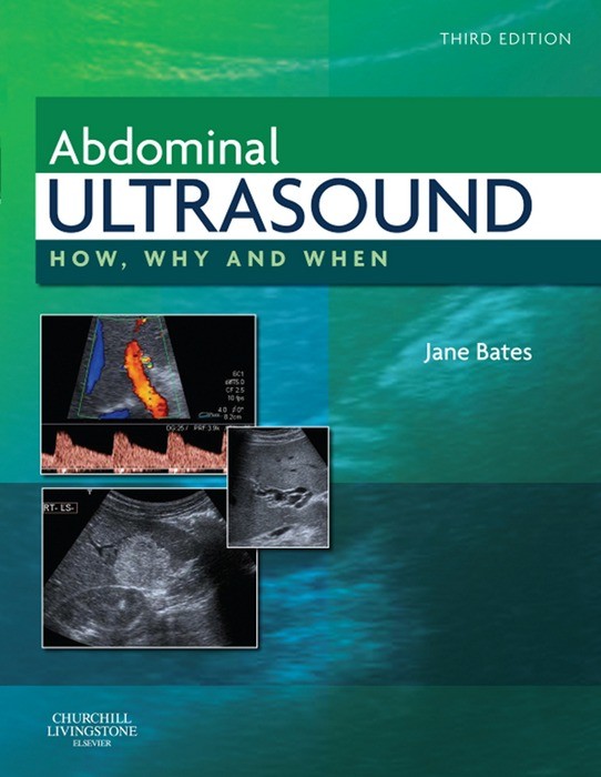 Abdominal Ultrasound