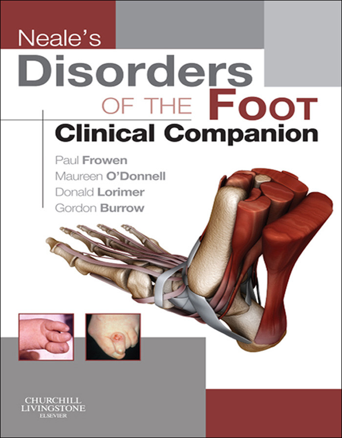 Cover Neale's Disorders of the Foot
