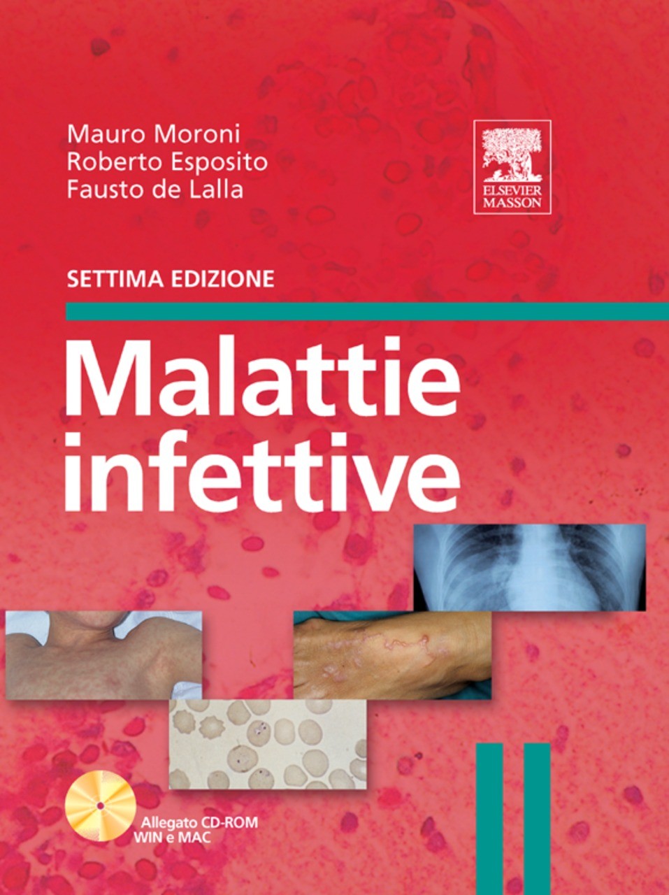 Cover Malattie infettive