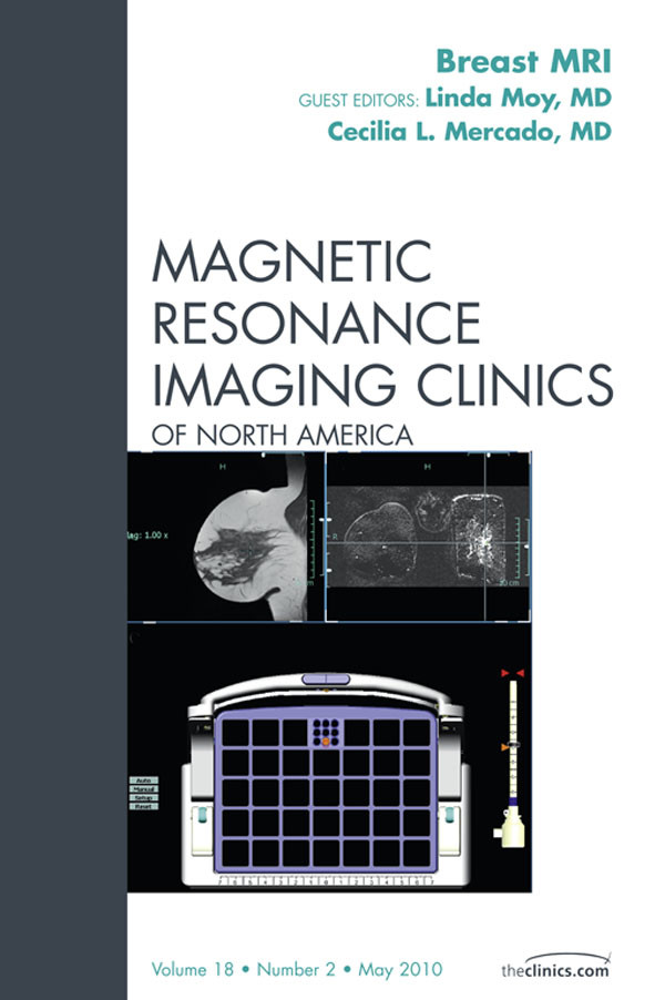 Cover Breast MRI, An Issue of Magnetic Resonance Imaging Clinics