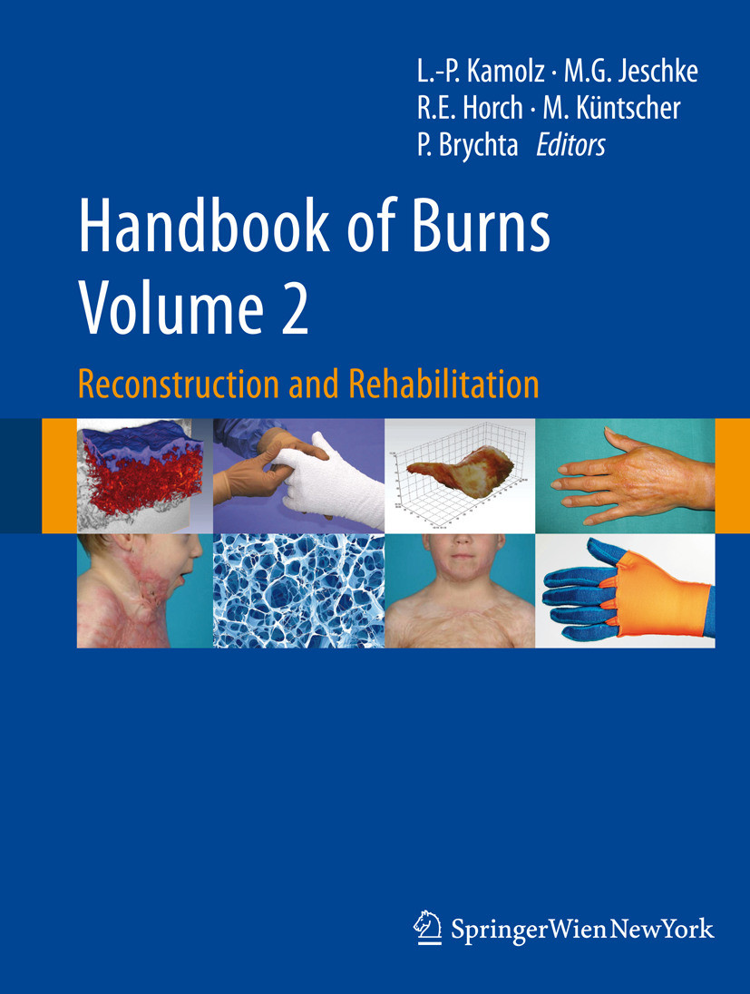 Cover Handbook of Burns Volume 2
