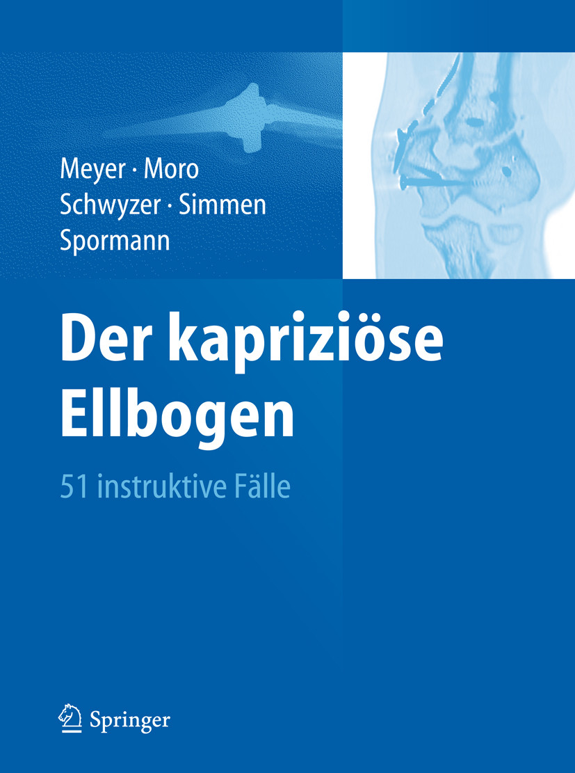 Cover Der kapriziöse Ellbogen