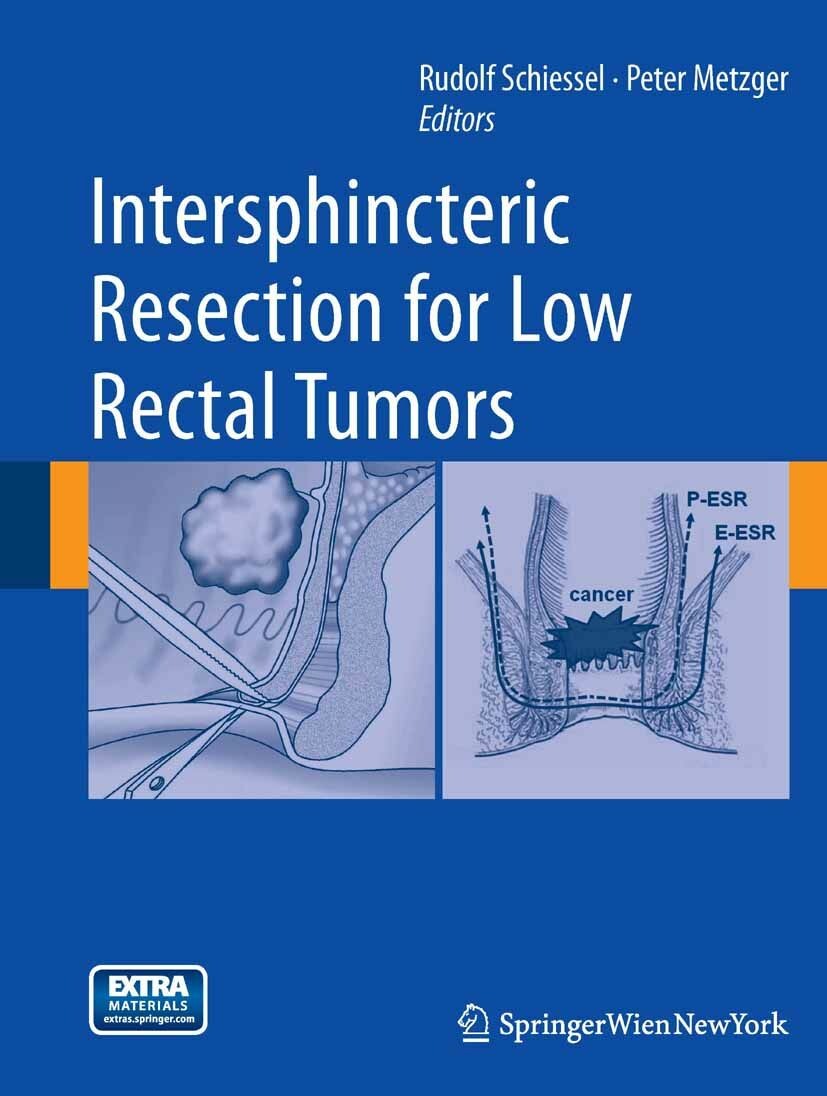 Cover Intersphincteric Resection for Low Rectal Tumors