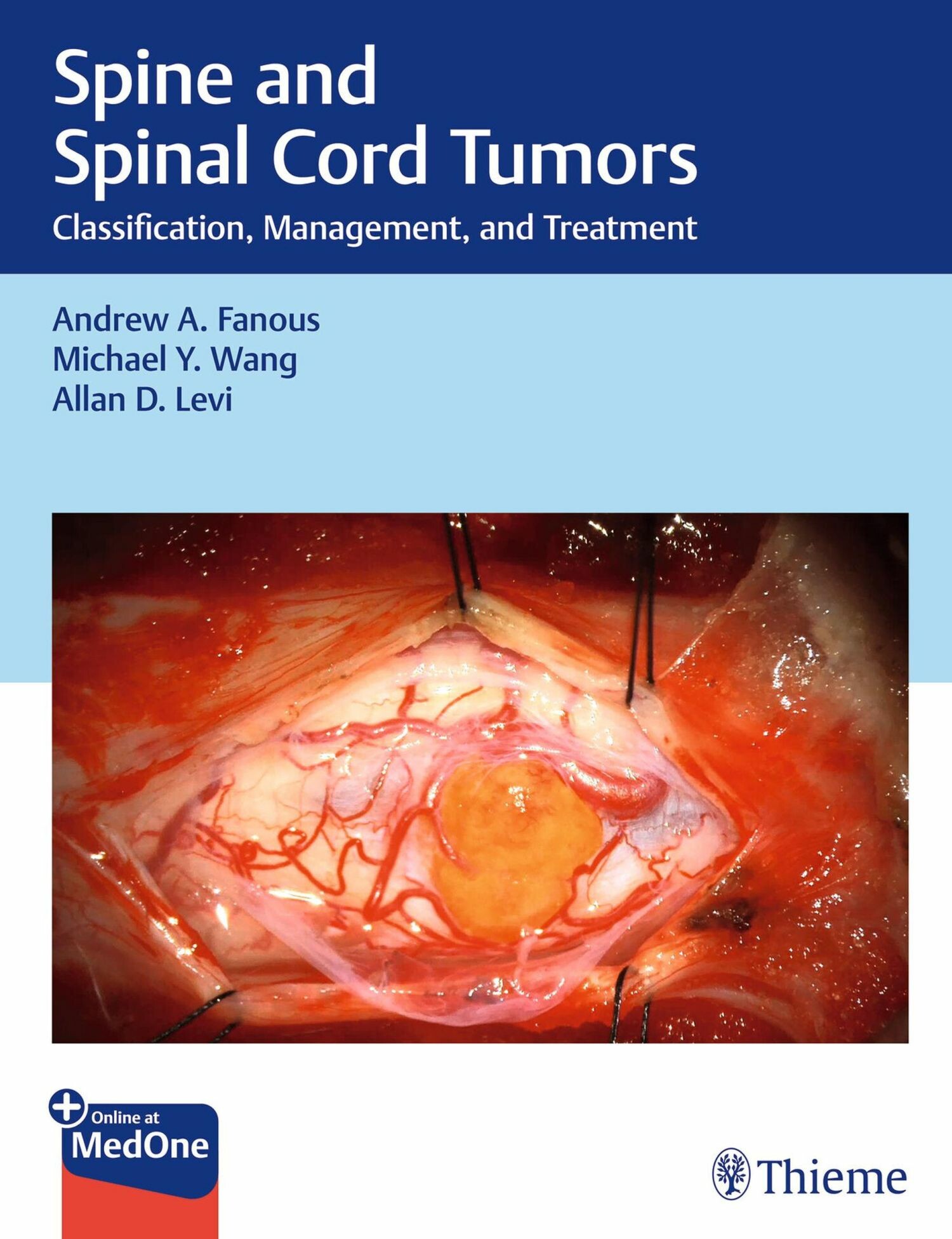 Cover Spine and Spinal Cord Tumors