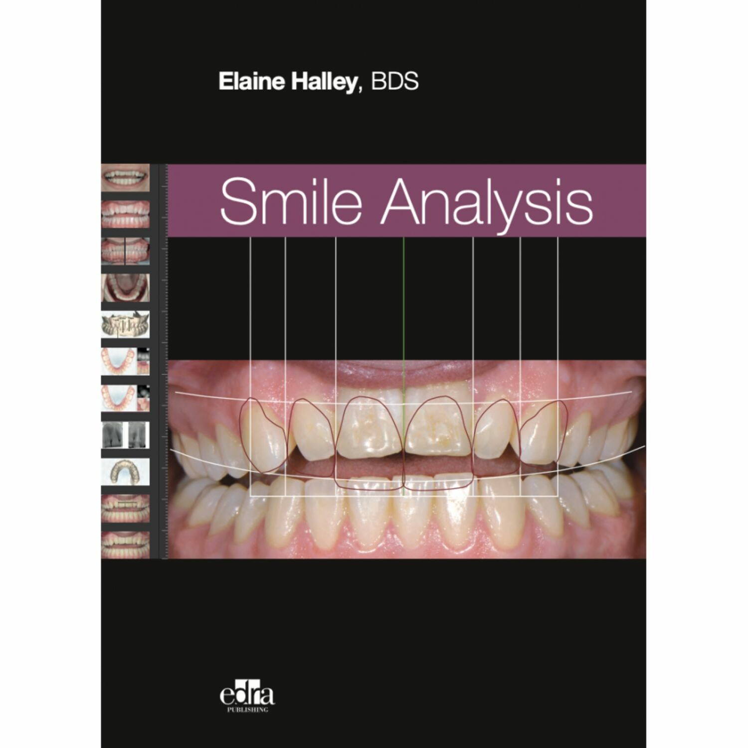 Cover Smile Analysis